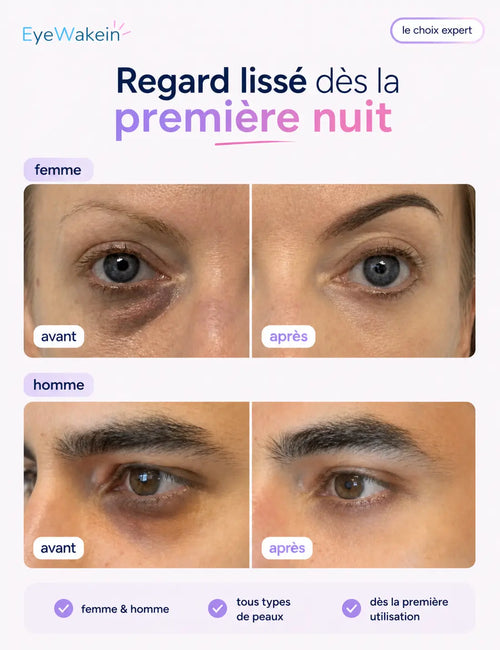 Patchs micro-aiguilles régénérant – Regard reposé en 10 minutes